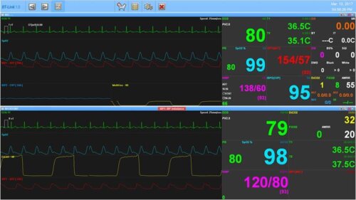 BT-Link Bionet veterinary monitors software screen