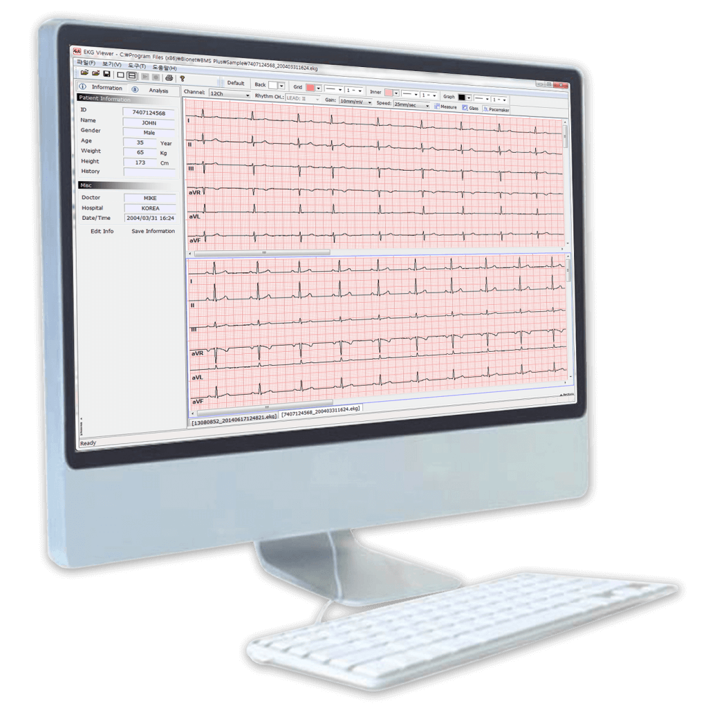 BMS-Plus - ECG/Spirometer Software - Bionet America