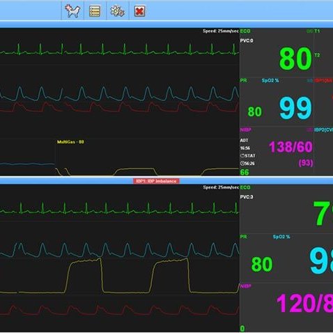 BT-Link Bionet Veterinary Monitor Software Screen
