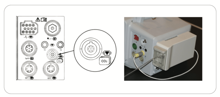 Bionet dual gas module connection