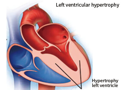 lab24-ventricles-heart