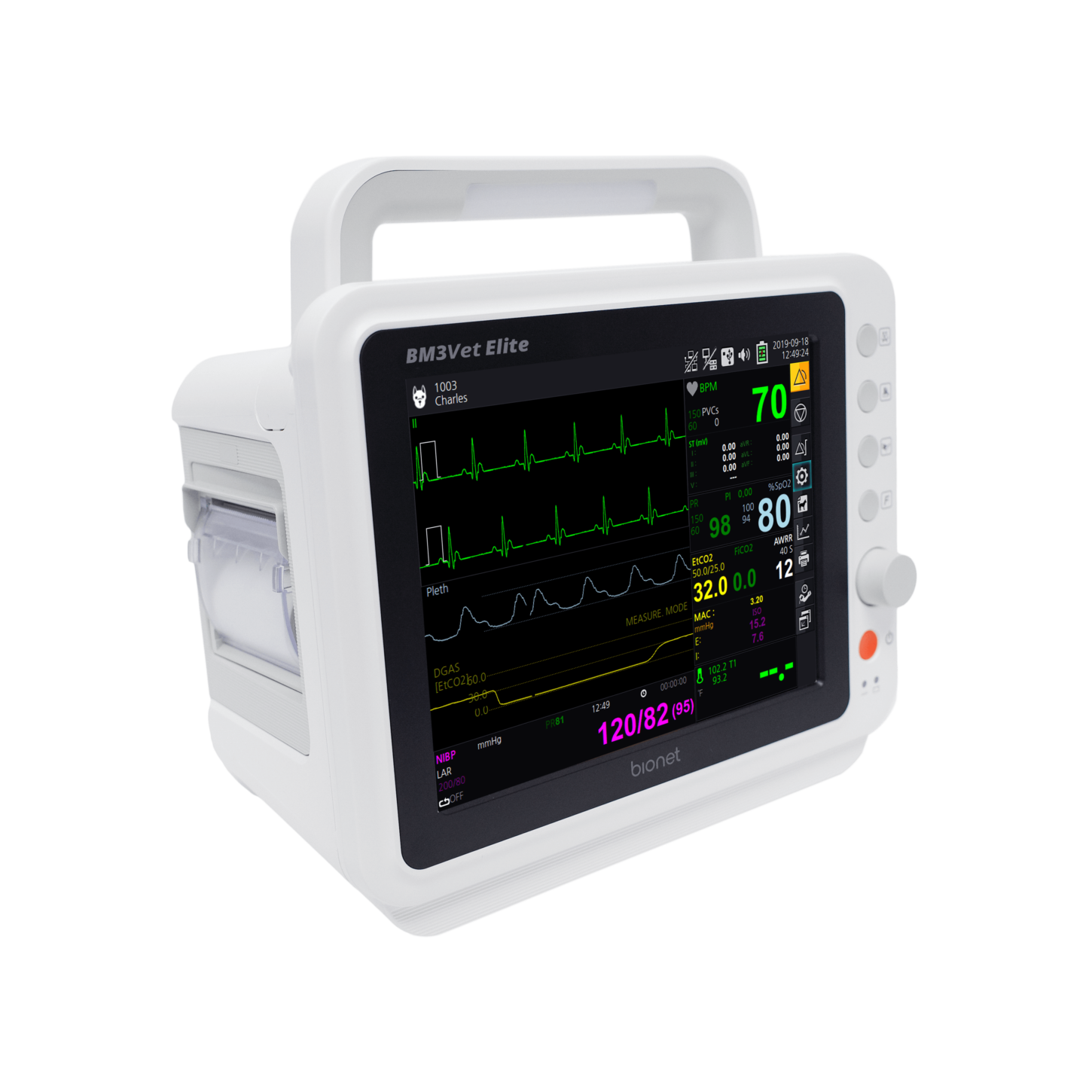 Mindray T1 Patient Monitor with Etco2