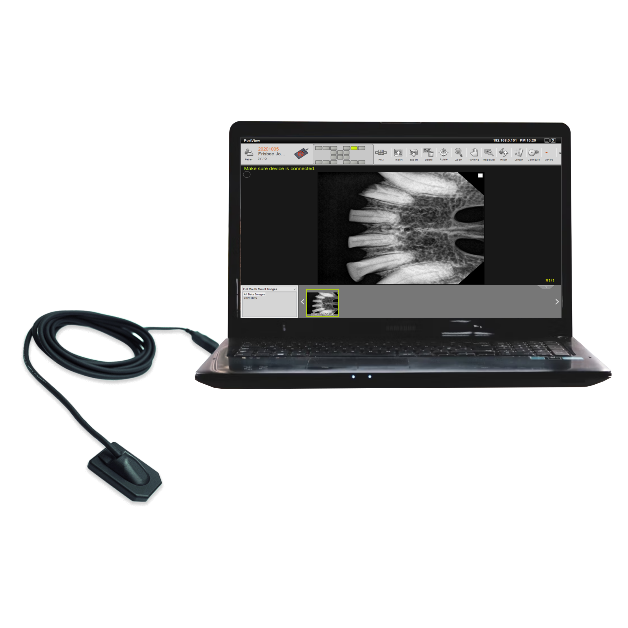 PortView Digital Dental IntraOral Sensor America