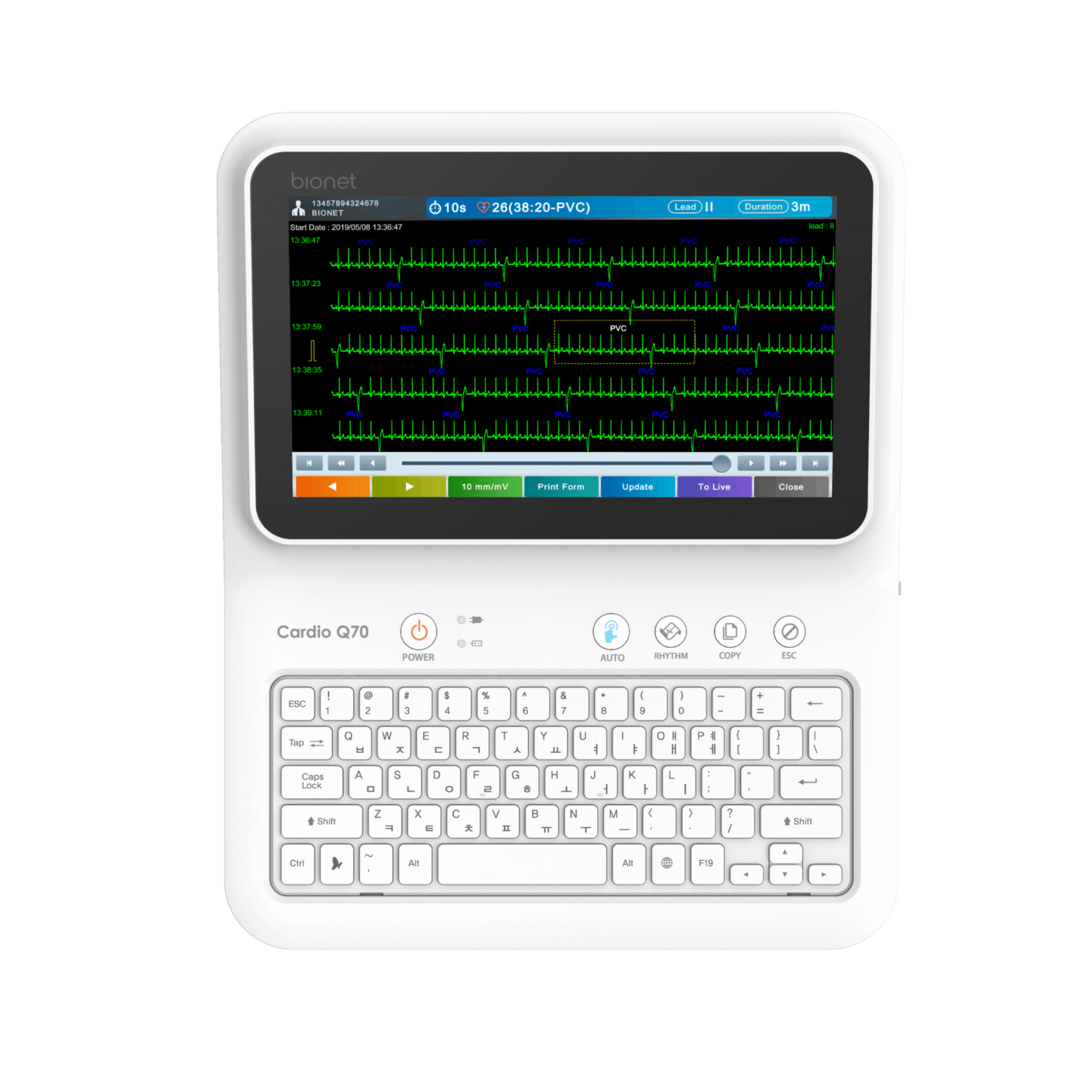 Bionet 12CH Resting ECG Cardio Q70