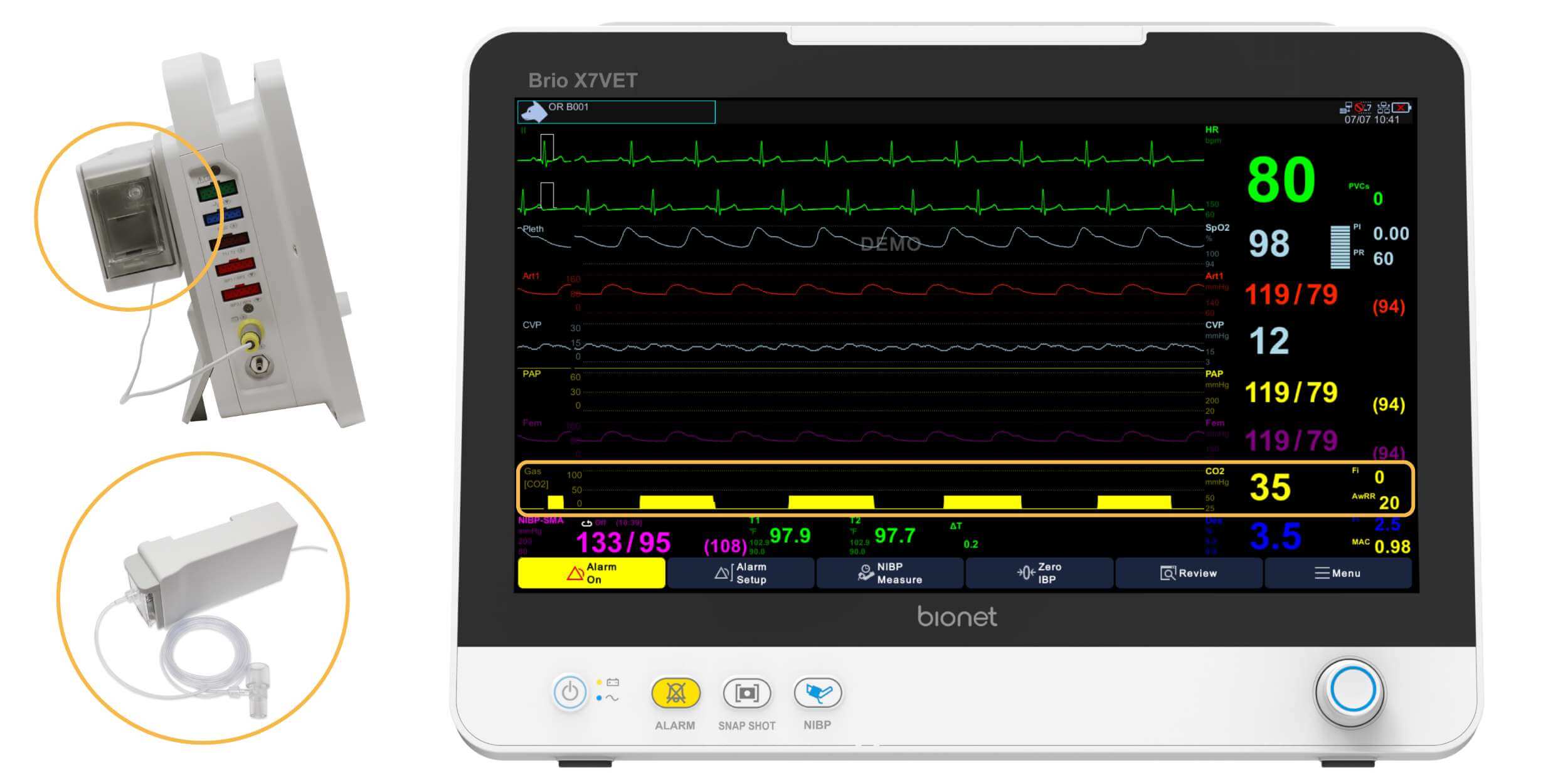 Why 'Just' EtCO2 Isn't Enough
